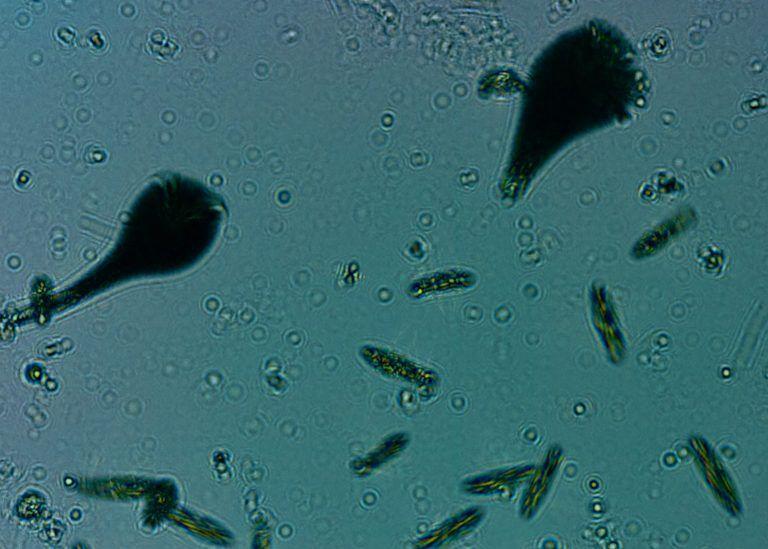 A variety of plankton seen through IBM’s autonomous microscope